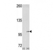 Western blot testing of 1) non-transfected and 2) transfected 293 cell lysate with EphA4 antibody. 