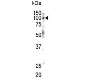 Western blot testing of mouse brain lysate with Eph Receptor B1 antibody. Predicted molecular weight ~110 kDa.