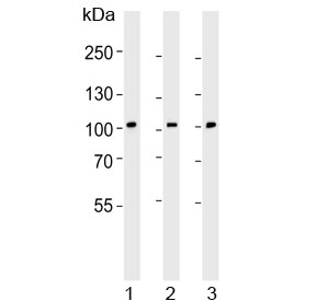 Western blot testing of human 1) A431, 2) HeLa and 3) MDA-MB-453 cell lysate with Eph Receptor B1 antibody. Predicted molecular weight ~110 kDa.