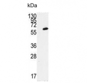 Western blot testing of (left) non-transfected and (right) transfected 293 cell lysate with FGR antibody.