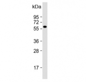 Western blot testing of human Raji cell lysate with FGR antibody. Predicted molecular weight: ~59 kDa, routinely observed at 55~59 kDa.