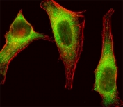 Immunofluorescent staining of fixed and permeabilized human HeLa cells with TEC antibody (green) and anti-Actin (red).