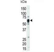 Western blot testing of mouse liver lysate with TEC antibody. Expected molecular weight: 58-73 kDa (multiple isoforms).