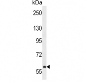 Western blot testing of human NCI-H292 cell lysate with TEC antibody. Expected molecular weight: 58-73 kDa (multiple isoforms).