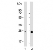Western blot testing of human 1) liver and 2) ovary lysate with NTF3 antibody. Predicted molecular weight ~29 kDa.