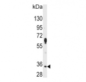 Western blot testing of human HeLa cell lysate with PIM2 antibody. Predicted molecular weight ~34 kDa.