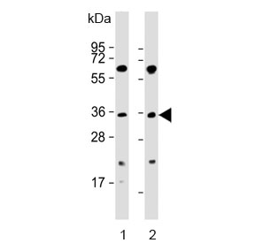 Western blot testing of human 1) K562 and 2) SW620 cell lysate with PIM2 antibody. Predicted molecular weight ~34 kDa.