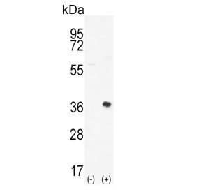 Western blot testing of 1) non-transfected and 2) transfected 293 cell lysate with PIM2 antibody.