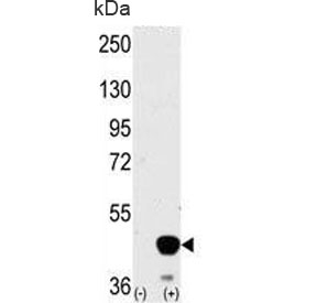 Western blot testing of 1) non-transfected and 2) transfected 293 cell lysate with MEK2 antibody.