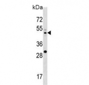 Western blot testing of human U937 cell lysate with MEK2 antibody. Expected molecular weight: 45-50 kDa.