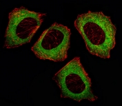 Immunofluorescent staining of fixed and permeabilized human U-251 cells with MEK2 antibody (green) and anti-Actin (red).