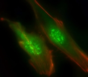 Immunofluorescent staining of fixed and permeabilized human HeLa cells with PI3KR1 antibody (green), DAPI nuclear stain (blue) and anti-Actin (red).