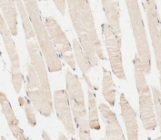 IHC testing of FFPE human skeletal muscle tissue with PI3KR1 antibody. HIER: steam section in pH6 citrate buffer for 20 min and allow to cool prior to staining.