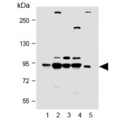 Western blot testing of human 1) A431, 2) Jurkat, 3) MCF7, 4) K562 and 5) rat brain lysate with PI3KR1 antibody. Predicted molecular weight ~84 kDa.