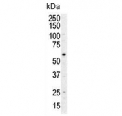 Western blot testing of human HL60 cell lysate with PI4K2A antibody. Predicted molecular weight ~54 kDa.