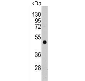 Western blot testing of mouse brain lysate with PI4K2A antibody. Predicted molecular weight ~54 kDa.