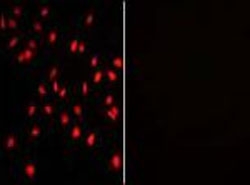Immunofluorescent staining of human HeLa cells with (left) and without (right) PI4K2A antibody (red).