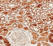 IHC testing of FFPE human kidney tissue with PEPCK1 antibody. HIER: steam section in pH9 EDTA buffer for 20 min and allow to cool prior to staining.