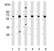 Western blot testing of 1) human liver, 2) human kidney, 3) human NCI-H460, 4) mouse liver, 5) mouse kidney and 6) rat kidney lysate with PEPCK1 antibody. Predicted molecular weight: ~69 kDa.