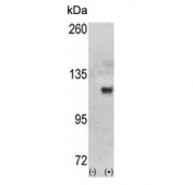 Western blot testing of 1) non-transfected and 2) transfected 293 cell lysate with Hexokinase antibody.