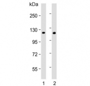 Western blot testing of rat 1) C2C12 and 2) brain lysate with Hexokinase antibody. Predicted molecular weight ~102 kDa.