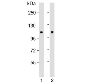 Western blot testing of human 1) MCF7 and 2) rat brain lysate with Hexokinase antibody. Predicted molecular weight ~102 kDa.