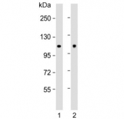 Western blot testing of rat 1) C2C12 and 2) rat brain lysate with Hexokinase antibody. Predicted molecular weight ~102 kDa.
