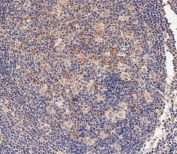 IHC testing of FFPE human tonsil tissue with Hexokinase antibody. HIER: steam section in pH6 citrate buffer for 20 min and allow to cool prior to staining.