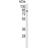 Western blot testing of human CCRF-CEM lysate with VAP-1 antibody. Predicted molecular weight ~85 kDa but may be observed at higher molecular weights due to glycosylation.