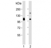 Western blot testing of human 1) lung and 2) liver lysate with VAP-1 antibody. Predicted molecular weight ~85 kDa but may be observed at higher molecular weights due to glycosylation.
