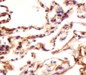 IHC testing of FFPE human lung tissue with VAP-1 antibody. HIER: steam section in pH6 citrate buffer for 20 min and allow to cool prior to staining.