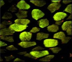 Immunofluorescent staining of FFPE human skeletal muscle with ATP5O antibody.