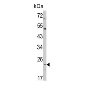 Western blot testing of human HEK293 cell lysate with ATP5O antibody. Predicted molecular weight ~23 kDa.