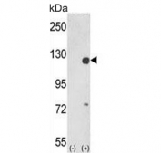 Western blot testing of 1) non-transfected and 2) transfected 293 cell lysate with Focal Adhesion Kinase antibody.