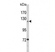 Western blot testing of human T47-D cell lysate with Focal Adhesion Kinase antibody. Predicted molecular weight ~119 kDa.