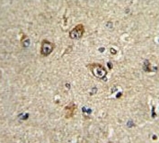 IHC testing of FFPE human brain tissue with Focal Adhesion Kinase antibody. HIER: steam section in pH6 citrate buffer for 20 min and allow to cool prior to staining.