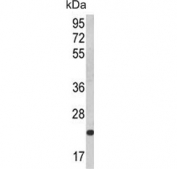 Western blot testing of human HL60 lysate with KLRC2 antibody. Predicted molecular weight ~26 kDa.