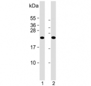 Western blot testing of human 1) uterus and 2) CCRF-CEM lysate with KLRC2 antibody. Predicted molecular weight ~26 kDa.