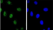 Immunofluorescent staining of human HEK293 cells with Estrogen-Related Receptor Alpha antibody (green) and DAPI nuclear stain (blue).