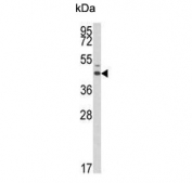 Western blot testing of human A375 cell lysate with Estrogen-Related Receptor Alpha antibody. Expected molecular weight: 46-52 kDa.