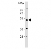 Western blot testing of human HeLa cell lysate with PXR antibody. Predicted molecular weight ~50 kDa.