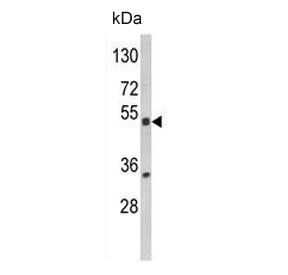 Western blot testing of human HL60 cell lysate with PXR antibody. Predicted molecular weight ~50 kDa.
