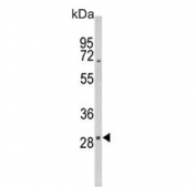 Western blot testing of human MCF7 cell lysate with DIO2 antibody. Predicted molecular weight ~31 kDa.