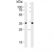 Western blot testing of human 1) heart and 2) skeletal muscle lysate with DIO2 antibody. Predicted molecular weight ~31 kDa.