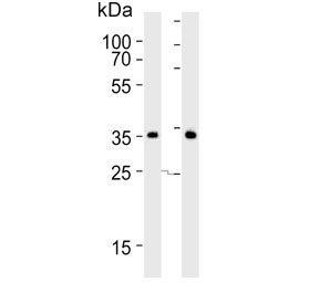 Western blot testing of human 1) heart and 2) skeletal muscle lysate with DIO2 antibody. Predicted molecular weight ~31 kDa.