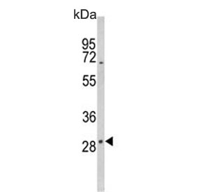 Western blot testing of human MCF7 cell lysate with DIO2 antibody. Predicted molecular weight ~31 kDa.
