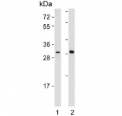 Western blot testing of 1) mouse heart and 2) human skeletal muscle lysate with DIO2 antibody. Predicted molecular weight ~31 kDa.