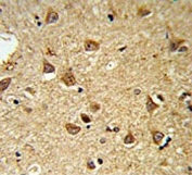 IHC testing of FFPE mouse brain tissue with DIO2 antibody. HIER: steam section in pH6 citrate buffer for 20 min and allow to cool prior to staining.