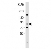 Western blot testing of human Daudi cell lysate with SCNN1A antibody. Predicted molecular weight ~76 kDa.