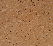 IHC testing of FFPE human brain tissue with PSMB1 antibody. HIER: steam section in pH6 citrate buffer for 20 min and allow to cool prior to staining.